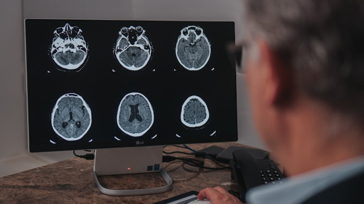 Maio Cinza: mês reforça a conscientização sobre o câncer cerebral