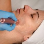 Rejuvenescimento facial movimenta setor estético no Brasil