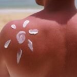 NoSunscreen: movimento viral preocupa especialistas
