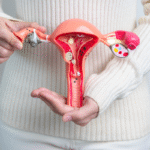 Endometriose severa: cirurgia robótica pode reduzir dor e riscos